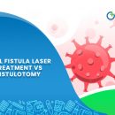 Anal Fistula Laser Treatment vs Fistulotomy