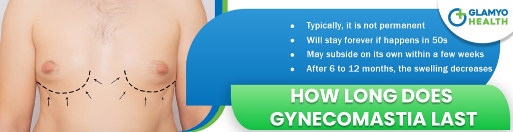 How long Does Gynecomastia Last