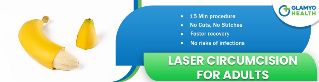 Laser Circumcision for adults