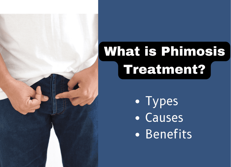What is Phimosis Treatment?