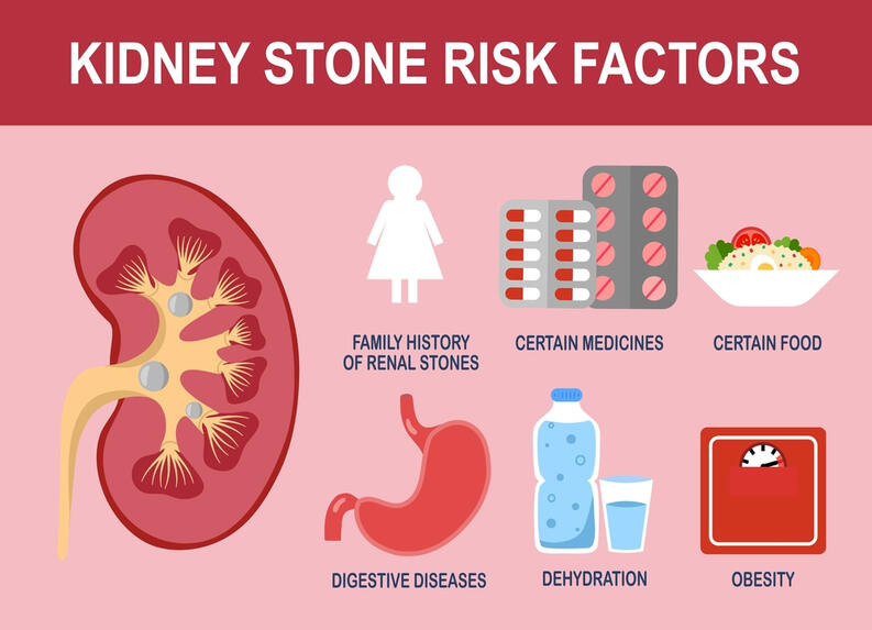 What causes Kidney Stones?