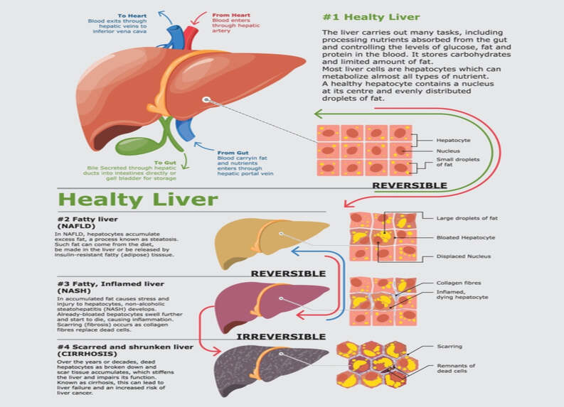 What is Healthy Liver