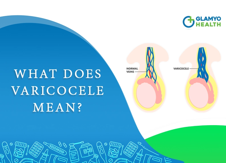 What Does Varicocele Mean?