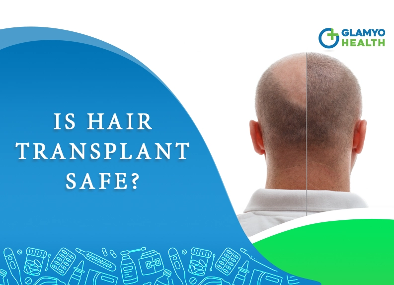 Does anyone have a positive experience of a hair transplant in Bangladesh  or India  Quora