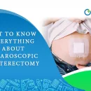 Get to Know Everything About Laparoscopic Hysterectomy