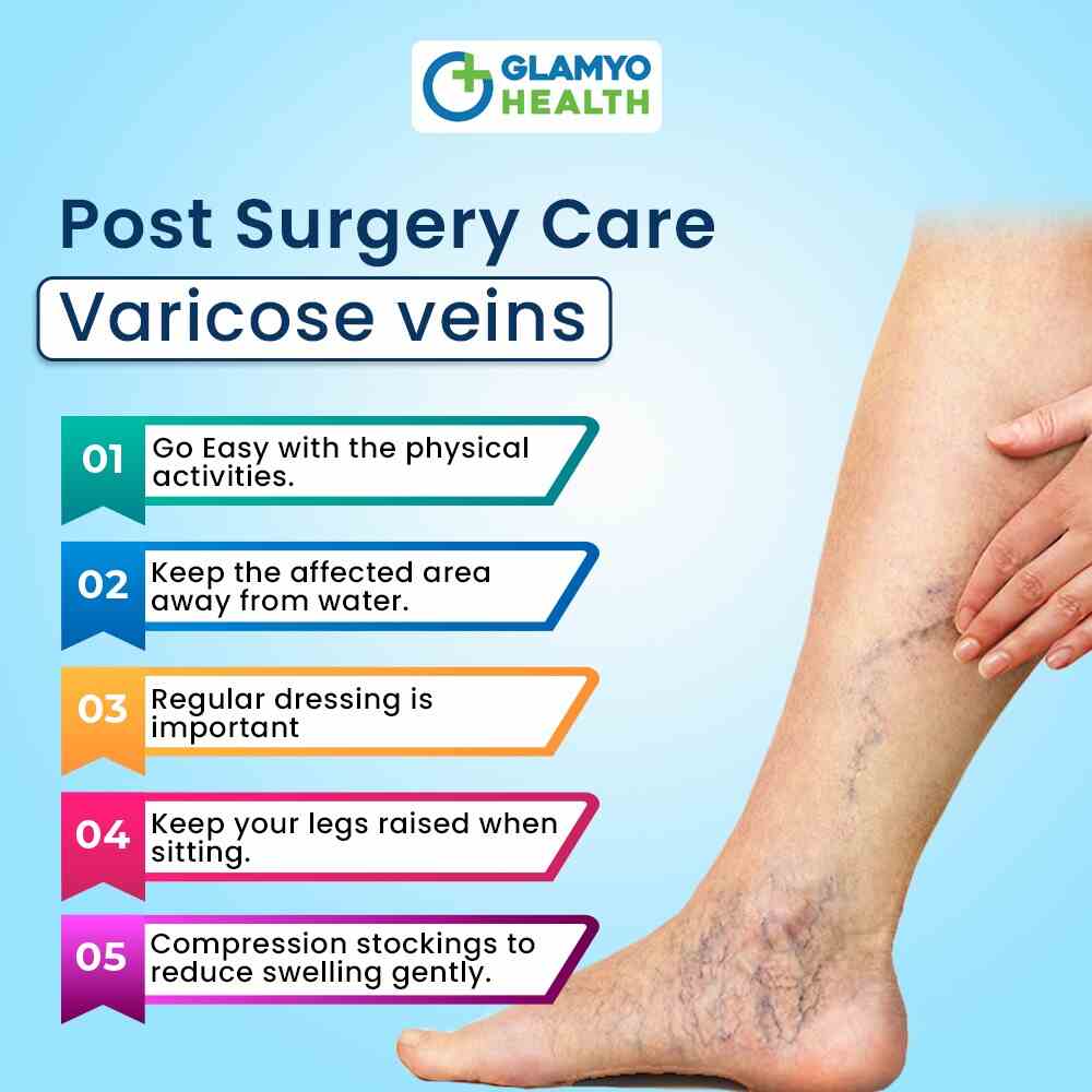 P0st Surgery Care Varicose Veins