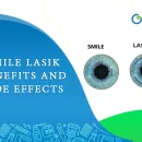 Smile Lasik Benefits and Side Effects