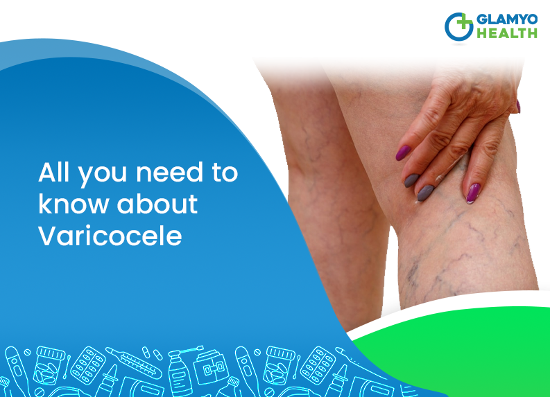 All You Need to Know About Varicocele