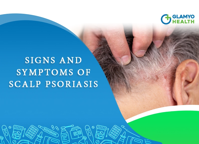 mild scalp psoriasis symptoms