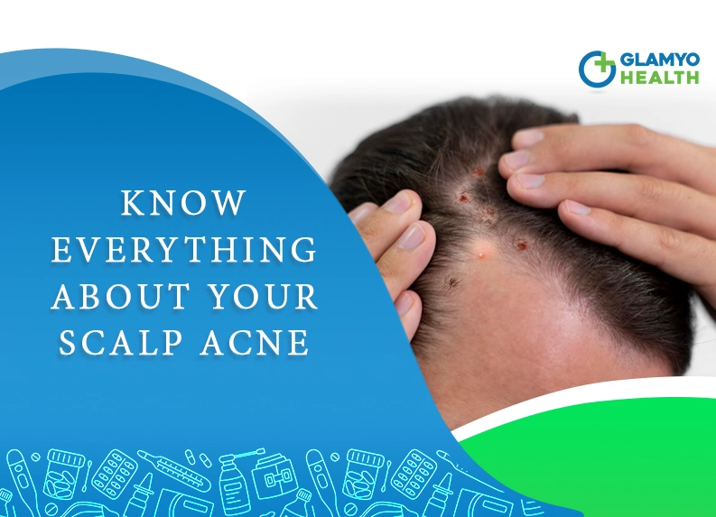Scalp Acne : Pimples on the head , Symptoms and Causes