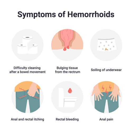 ymptoms of hemorroids 