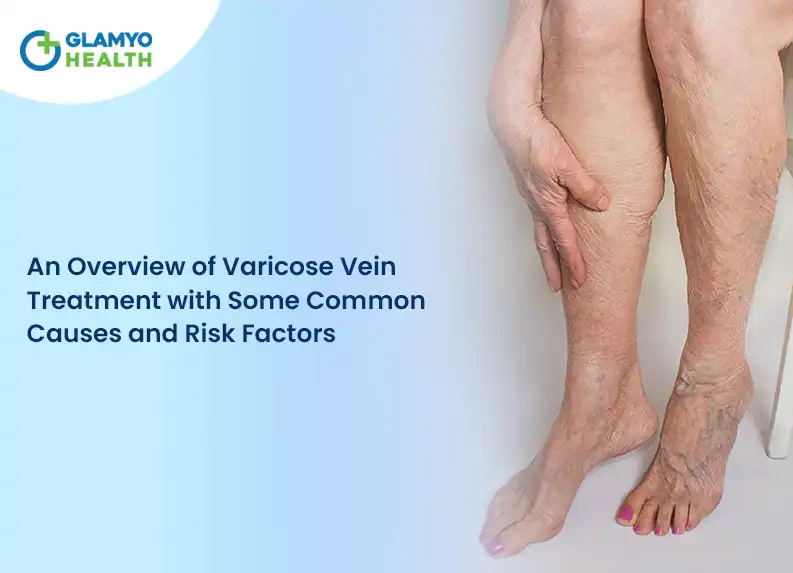 An Overview of Varicose Vein Treatment with Some Common Causes and Risk Factors