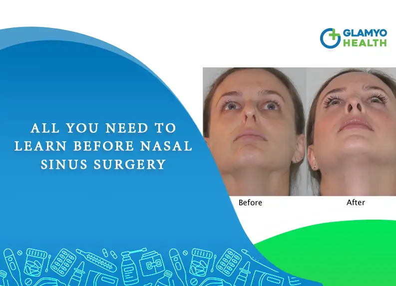 All You Need To Learn Before Nasal Sinus Surgery