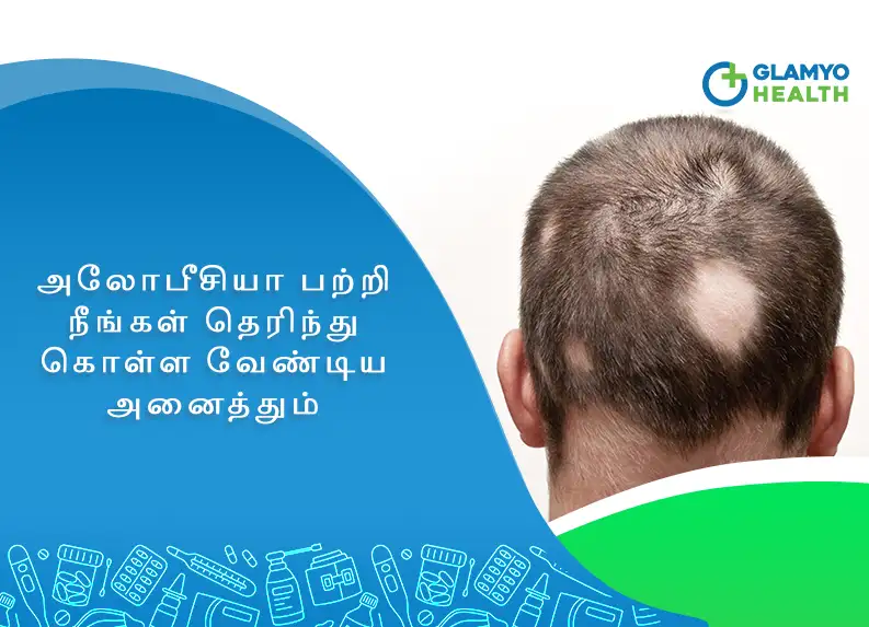 மட நறய கடடத ஒர நளகக எததன மட வர கடடன பரசசன  இலல  Hair Loss Causes Symptoms Treatment And Prevention  Tamil  BoldSky