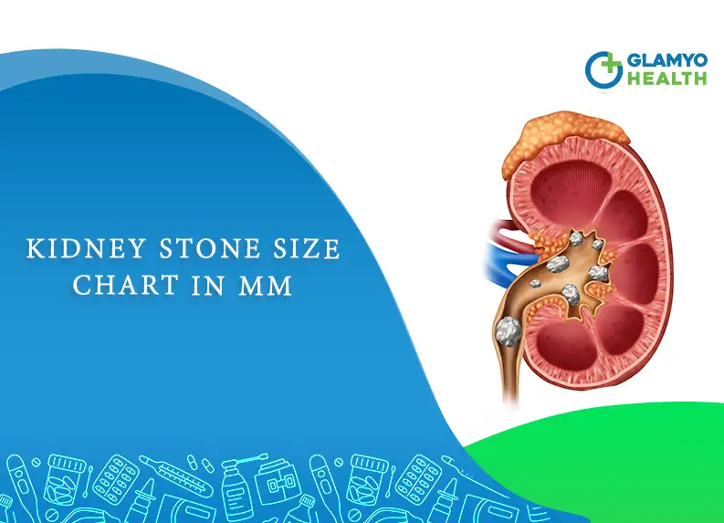 kidney stone 4mm