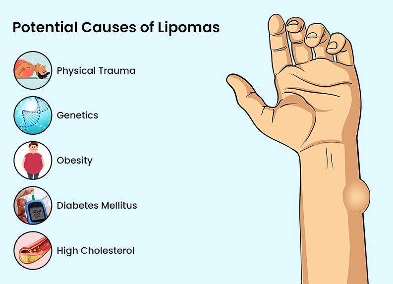 Causes of Lipoma