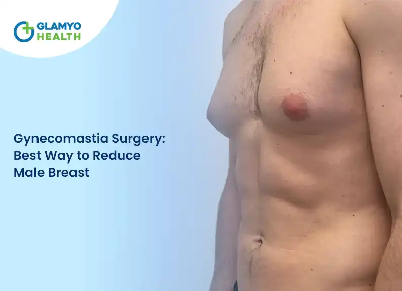 Gynecomastia Surgery: Best Way to Reduce Male Breast
