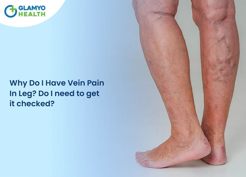 Why Do I Have Vein Pain In Leg? Do I Need to Get it Checked?