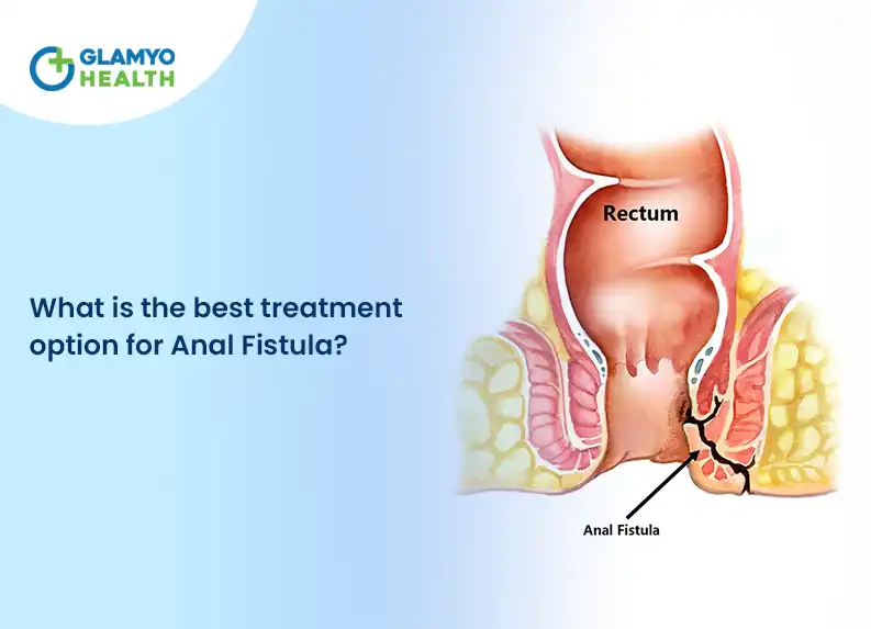 What is the Best Treatment Option for Anal Fistula?