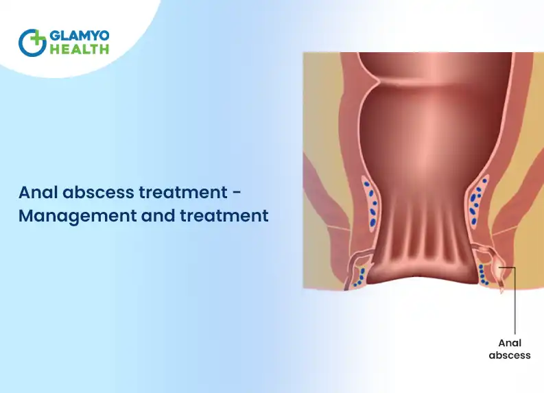 Anal Abscess Treatment &#8211; Management and Treatment